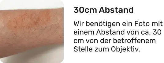 Bild eines Arms als Beispiel unseres Photo-Uploads
