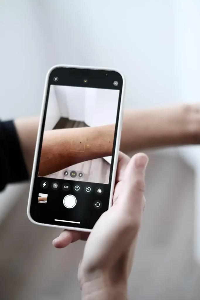 Person zeigt mich Smartphone auf den Arm und nimmt Bild der Haut